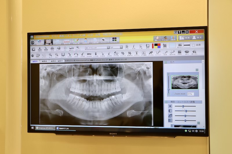 患者様用モニタ(山梨県_歯医者)