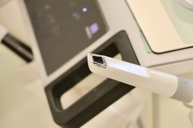 口腔内高輝度カメラ(山梨県_歯医者)